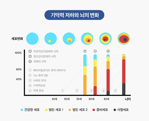 기억력 저하와 뇌의 변화 그래프